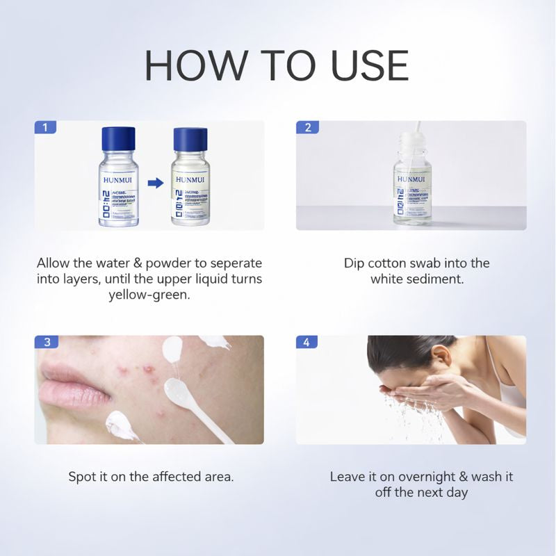 HUNMUI Acne Lotion